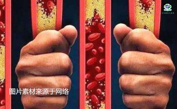 不想給血管“添堵”，盡量少吃以下這些東西，或許能讓腦梗離遠些  
